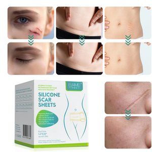 Scar Removal Silicone Tape for Hypertrophic Scars & Keloids, 1.6'' x 60"